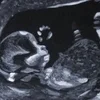 МАМСКИЙ КЛУБ🍼тут➡️