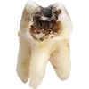 Эмодзи Rotten core